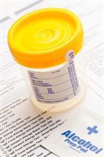 Drug Test